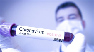 Hà Nội lên kế hoạch lập bệnh viện dã chiến với Corona virus